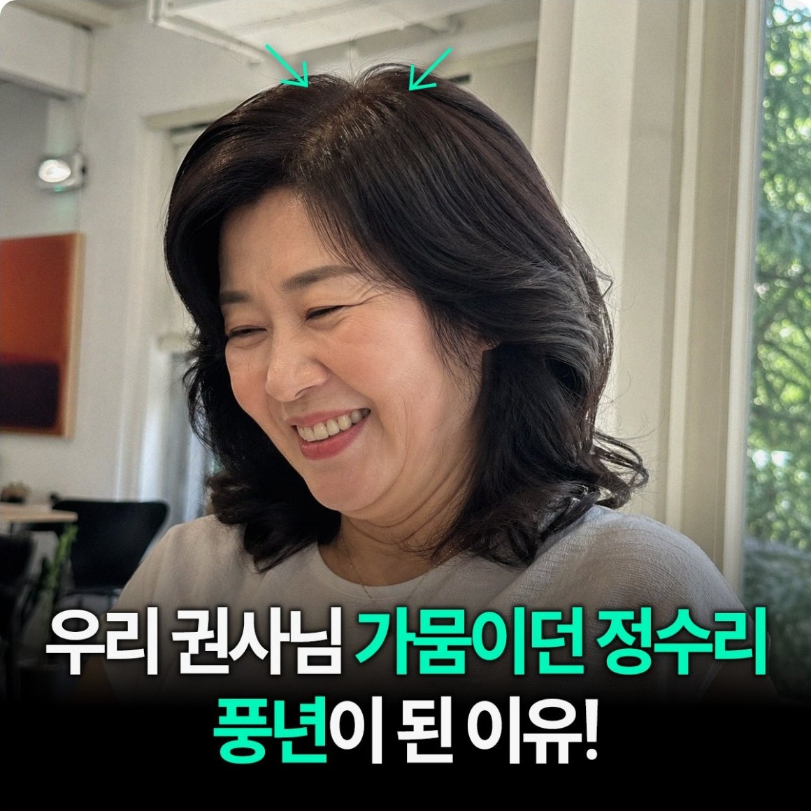 밝은 실내 창가에서 환하게 웃는 중년 여성 사진 위에 '우리 권사님 가뭄이던 정수리 풍년이 된 이유!' 라는 광고 카피가 얹혀 있다