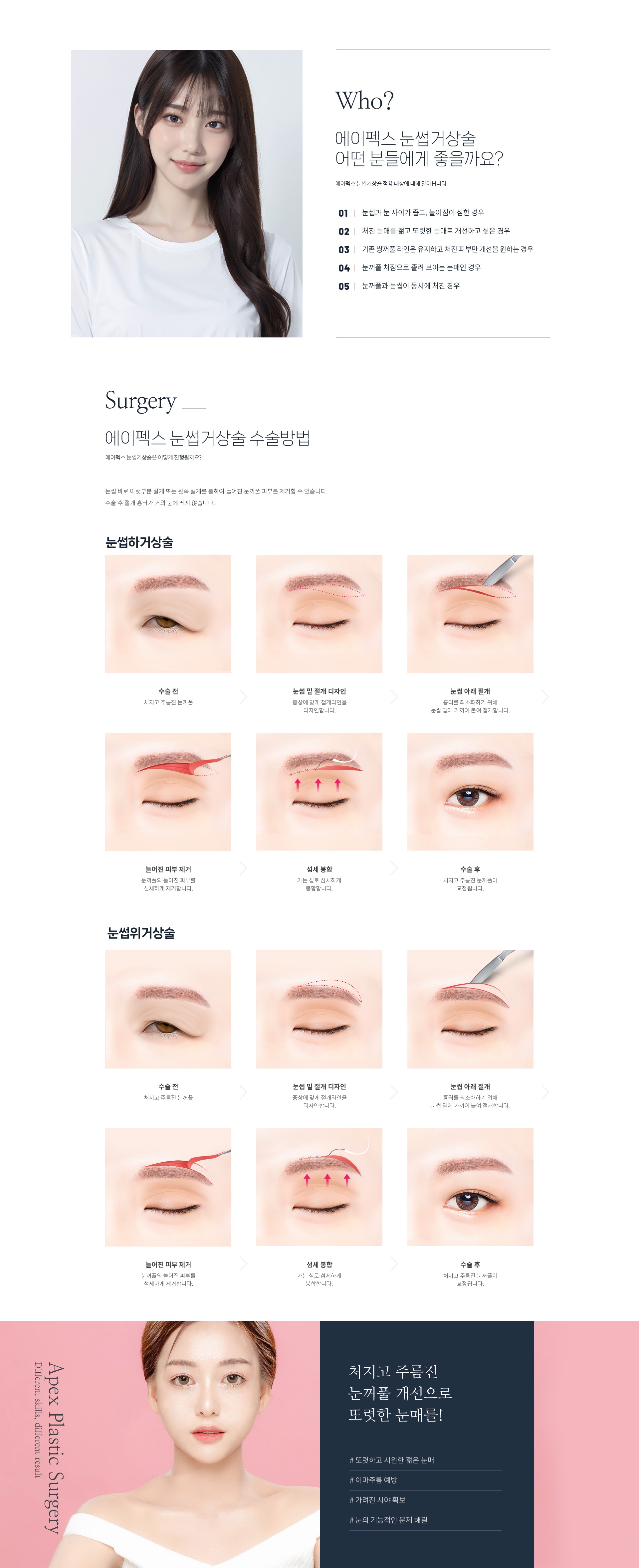에이펙스성형외과 눈썹거상술 원본 이미지