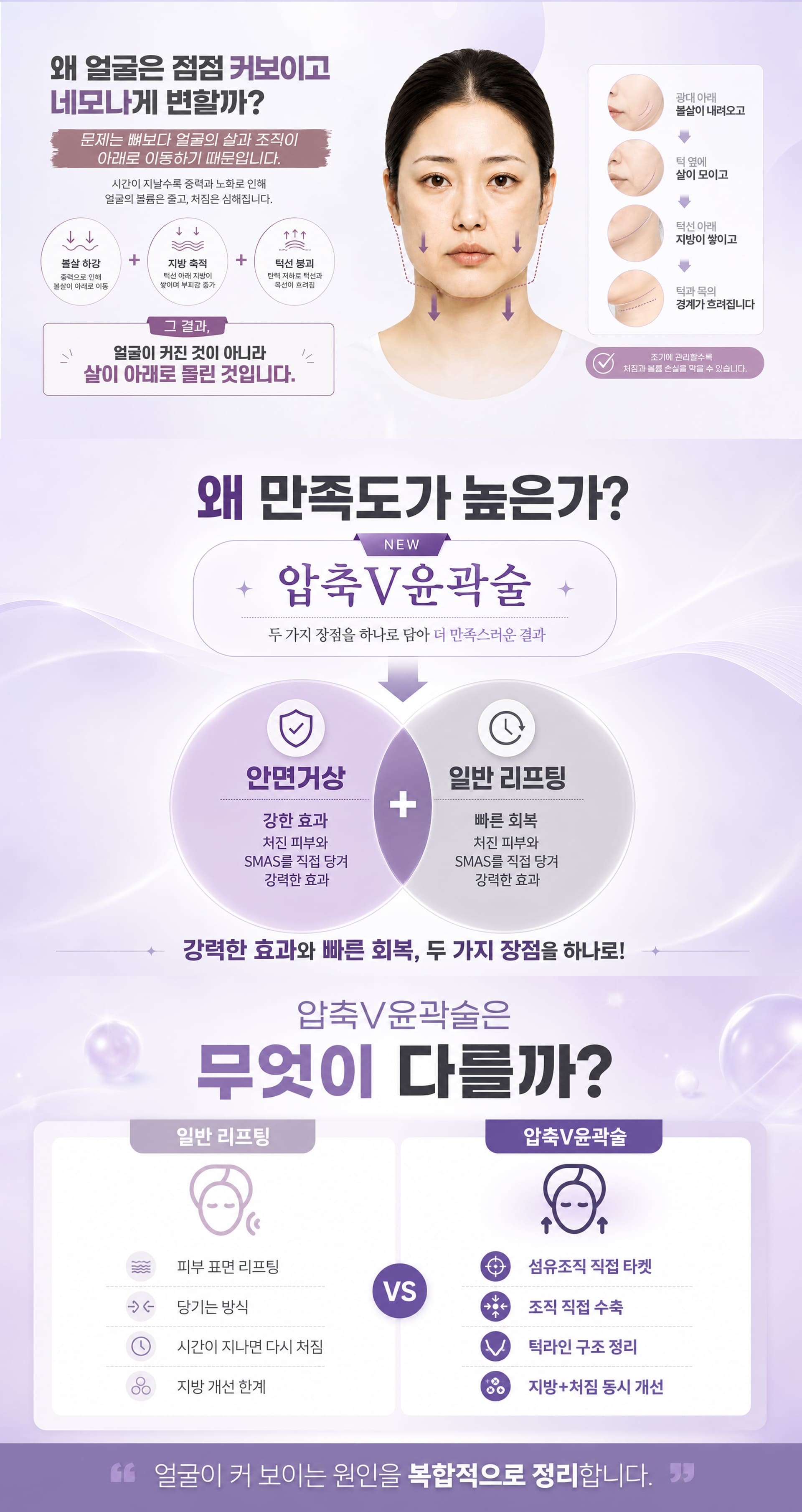 SH성형외과 압축V윤곽술