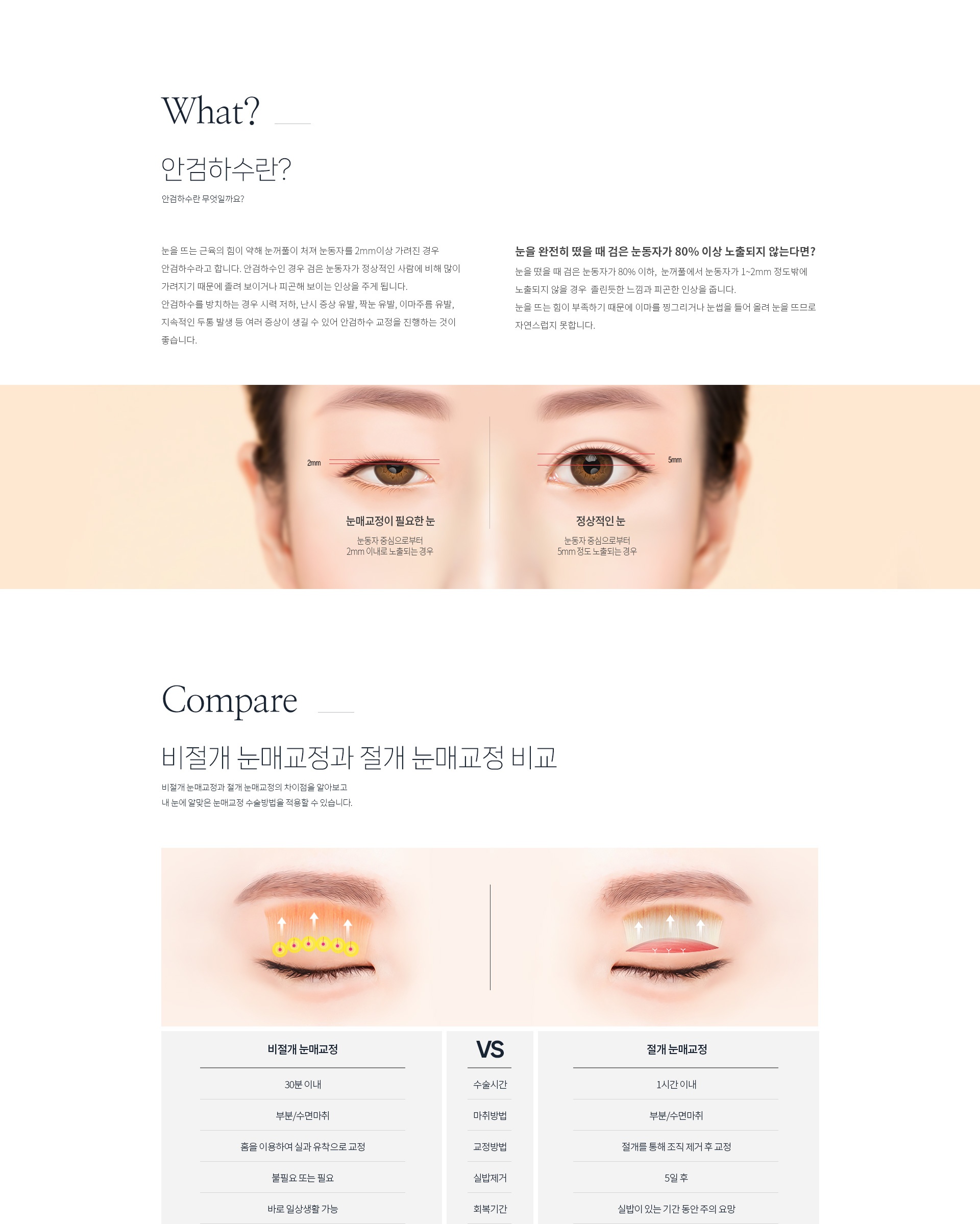 안검하수 눈매교정 비교 원본 이미지