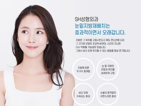 SH성형외과 눈밑지방재배치 변환 결과