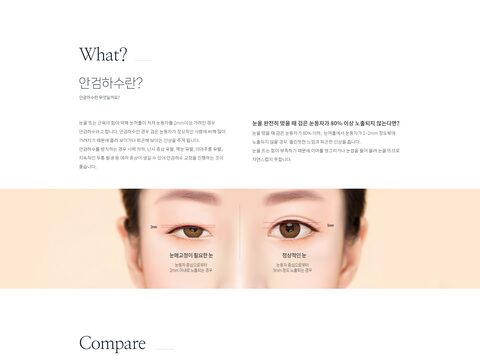 안검하수 눈매교정 비교 변환 미리보기